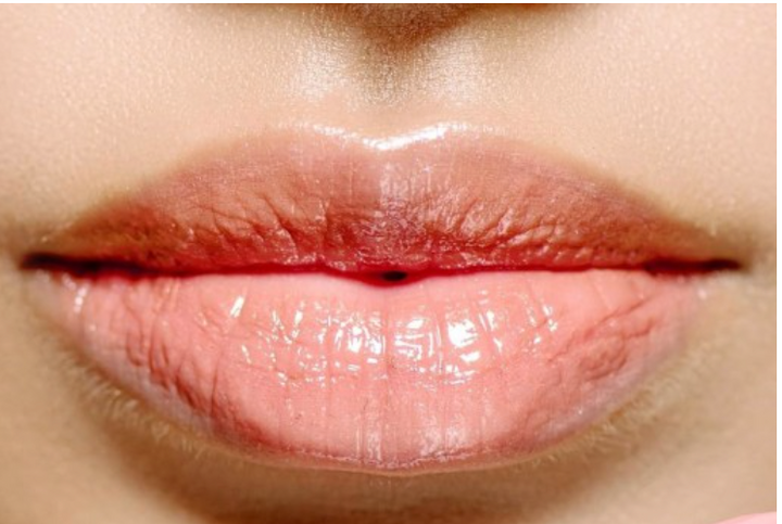B Esta Skincare: 5 Reasons It’s Trending in 2025